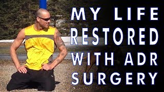 Lumbar Disc Replacement Surgery from Dr Ritter Lang and the Enande Team [upl. by Bryanty311]