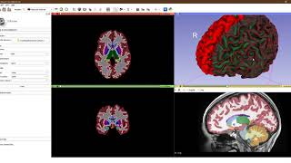 Import FreeSurfer subjects into 3D Slicer [upl. by Stinson]