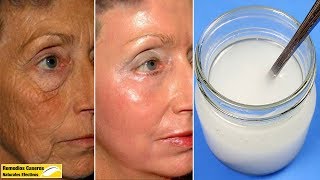 Despídete De Las Arrugas Y Manchas En La Cara Usando Esta Mascarilla Botox [upl. by Eserehc691]