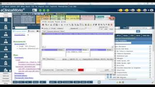 Improved workflow for ordering Labs Imaging and Procedures in eClinicalWorks [upl. by Rehpotsirahc367]