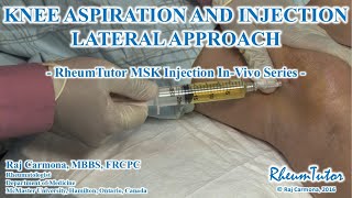 KNEE ASPIRATION  INJECTION LATERAL APPROACH  InVivo Series [upl. by Lisha19]