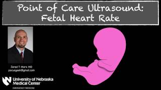 Measuring Fetal Heart Rate with MMode [upl. by Sibby]