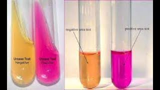 Urea hydrolysis test or Urease test [upl. by Ahseinek]