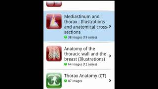 IMAIOS eAnatomy Mobile app for Android [upl. by Yasmeen]