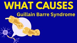 What causes Guillain Barre Syndrome [upl. by Ycal]