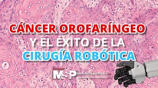 Cáncer orofaríngeo y la cirugía robótica  CápsulaEducativaMSP [upl. by Andrea140]