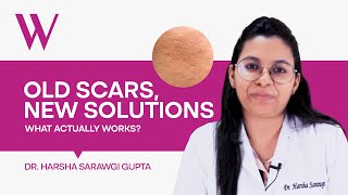 How to Minimize Scars Effective Treatments and Prevention Tips by Dr Harsha Sarawgi Gupta [upl. by Rosemary638]