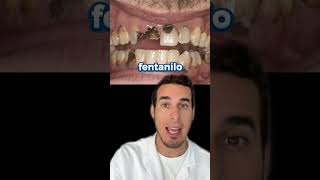 FENTANILO EFECTOS en los DIENTES  Así afecta su consumo [upl. by Norrab503]