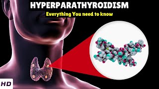 Hyperparathyroidism – Types Causes Signs and Symptoms Diagnosis amp Treatment [upl. by Lamak867]