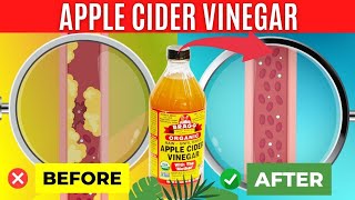 I tried Apple Cider Vinegar for 2 weeks Amazing Apple Cider Vinegar Benefits [upl. by Berry]