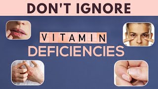 18 Common Signs Of Nutrient Deficiency In Your Body How To Fix Them  HealthyLifeVibes [upl. by Radke]