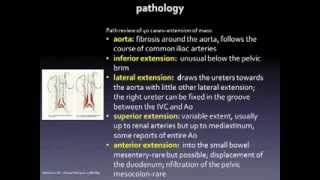 Retroperitoneal Fibrosis [upl. by Noned]