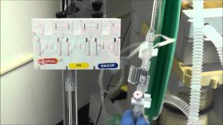 How to Setup an Arterial Line Transducer [upl. by Roseline654]