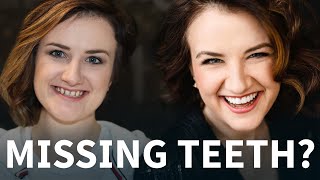 Missing Teeth  Smile Makeover with Veneers Bridges and Invisalign [upl. by Ttelrahc]