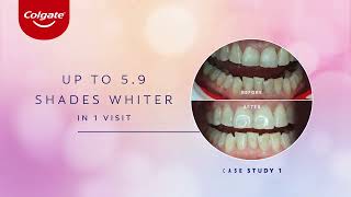 Colgate Optic White LightUp 10 InOffice Whitening Kit [upl. by Enomor753]