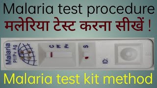 Malaria test kit method  Malaria test procedure  Malaria test kaise kiya jata hai [upl. by Mcnally]