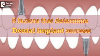 5 factors that determine Dental implant success  Dr Manesh Chandra Sharma [upl. by Nilrah]