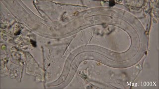 Nematodes under the Microscope  Friend or Foe [upl. by Bray]