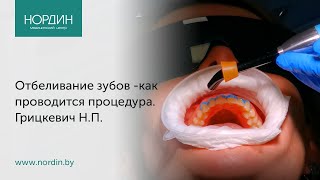 Отбеливание зубов  как проводится процедура что такое quotбелаяquot диета [upl. by Ligriv]