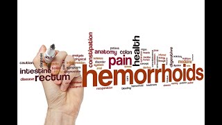 Hémorroïdes  Symptômes diagnostic et options de traitement  Emborrhoid  un remède sans douleur [upl. by Modestine]