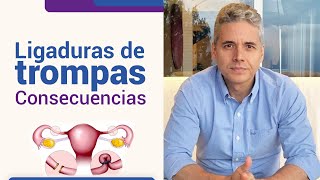 Consecuencias de la ligadura de trompas l Dr Juan Luis Giraldo [upl. by Drarehs]