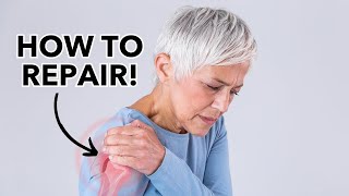 Shoulder SLAP Tear amp Repair What Where How We have answers [upl. by Astrea]