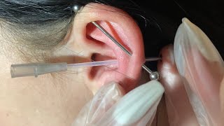 close up conch piercing at home [upl. by Pul]