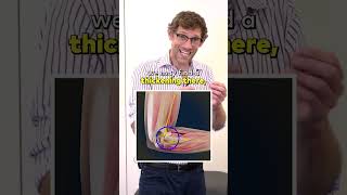 How to Check Your Elbow Pain [upl. by Natie]