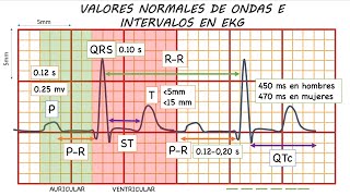 ELECTROCARDIOGRAMA NORMAL GUÍA DEFINITIVA [upl. by Egrog]