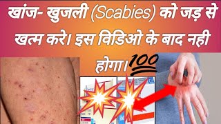 scabies खांज खुजली Scabies को जड़ से खत्म करे। इस विडिओ के बाद नही होगा। Abhia2zmedical [upl. by Enautna848]