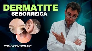 Como controlar a Dermatite Seborreica [upl. by Odrahcir]