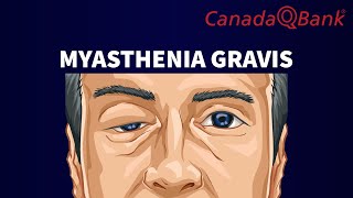 Myasthenia Gravis [upl. by Tteragram]