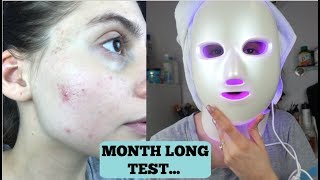 I TRIED AN LED LIGHT THERAPY MASK FOR MY ACNE FOR ONE MONTH  What happened my thoughts [upl. by Celestia]