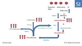 Hemolytic hepatic and obstructive Jaundice explained [upl. by Nollie]