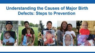 Understanding the Causes of Major Birth Defects Steps to Prevention [upl. by Nilahs]