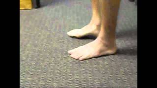 Severe ankle sprain  painfree running and jumping after 4 treatments mp4 [upl. by Sigvard519]