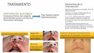 PATOLOGIAS DEL RECIEN NACIDO malformaciones congénitas [upl. by Kym]