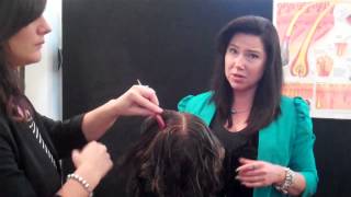 Hair Loss Natural Treatments with Microneedle Therapy [upl. by Hillard886]