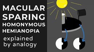 Macular Sparing amp Splitting Homonymous Hemianopia  Animation  Explained Conceptually [upl. by Moreno]