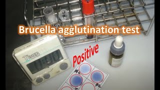 Brucella rapid agglutination test [upl. by Nahtaneoj]