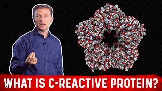 What is CReactive Protein amp How to Lower it – Dr Berg [upl. by Mitzie]