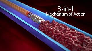 Aspirex™ Thrombectomy System 3in1 Mechanism of Action [upl. by Nnylg]