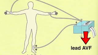 🔴 LES 12 DÉRIVATIONS ECG EXPLIQUÉES TRÈS CLAIREMENT  DR ASTUCE [upl. by Bohner]