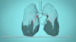 OMS Respira la Vida  Cómo la contaminación del aire afecta a tu cuerpo [upl. by Amund]