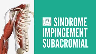 ¿Qué es Síndrome Pinzamiento SUBACROMIAL IMPINGEMENT TUTORIAL [upl. by Zanze]