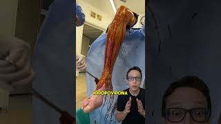 Artroscopia de Joelho 😱medicina medico enfermeiro enfermagem fisioterapia fisioterapeuta [upl. by Omarr836]