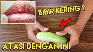 Cara Mengatasi Bibir Kering [upl. by Suoiluj621]