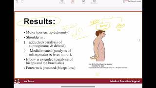 Brachial plexus injury [upl. by Fae]