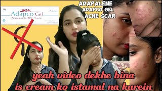 Dont use without watch this video  Adapco gel  adapalene gel 01  adapalene benefit ampside effect [upl. by Rasaec482]