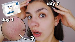 I Used Dove Soap On My Skin Everyday For One Week [upl. by Kala]